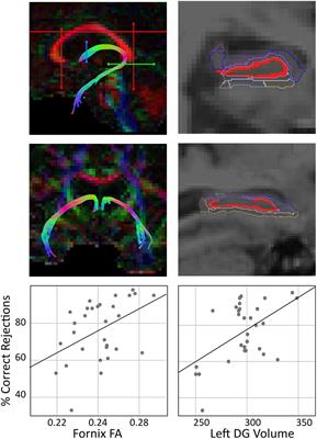 Frontiers | Dentate Gyrus Volume Mediates The Effect Of Fornix ...